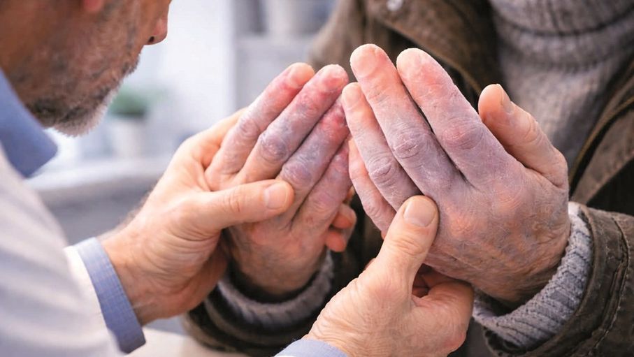 برودة "المربعانية".. خطر خفي يتسلل لأطراف كبار السن