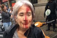 اصابات فى استفتاء كتالونيا