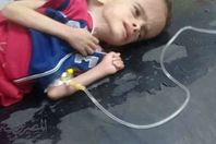 بالصور والمستندات الطفل ياسين ابن الاسكندرية يصارع الموت