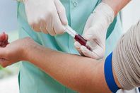 تحليل المخدرات