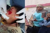 سيدة تطلق كلبها على زميل ابنتها بالمدرسة