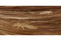 نهاية مروعة لطفلة.. مات بـ" لدغات القمل"
