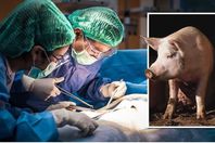 us-surgeons-transplant-pig-kidney-human-nuy-langine-health-1509341