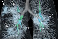 6D0B91D3-DF18-43BE-8F58-3BEF3DCA81BD