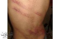 مدرس أزهرى يعتدى على تلميد بوحشية ويضربة بـ " الكرباج "