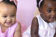 أغرب  توأم  فى  العالم