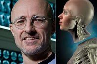 نجاح أول عملية زراعة رأس بشرية في العالم