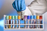 إغلاق  16 معمل ومركز طبي بأسوان