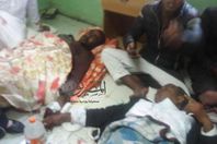 تكدس لمصابي التفجير داخل مستشفي بئر العبد