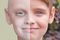 مرض السرطان