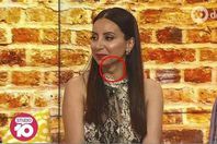 لطوف والورم في عنقها