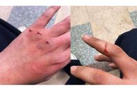 79320920436620251126115507557