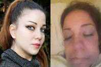 عملية تجميل تُشوّه وجه الفنانة اللبنانية تينا زبيدي