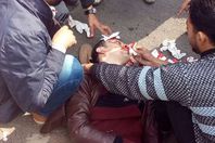 سيارة تدهس معيد بجامعة الأزهر أمام الباب الرئيسي