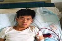 صينى باع كليته