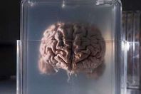 تجميد الأعضاء البشرية