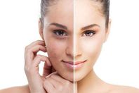 بشرة خالية من البقع الداكنة 
