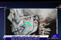 صورة من الفيديو