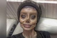 الشابة سحر بعد العمليات