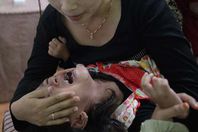 ختان الإناث