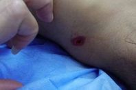 صورة الطفلة