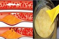 خلطة سحرية لعلاج انسداد الشرايين