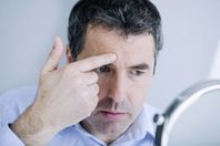 علاج-تجاعيد-الوجه-للرجال