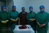 ستئصال ورم يزن 12 كيلو من معدة مريض داخل مركز أورام طنطا