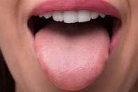 تنميل اللسان 
