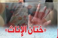 ختان الإناث