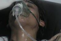 اختناق 3 عمال دخل غرفة الصرف الصحي بالمنوفية