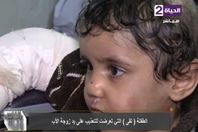 طفلة التعذيب