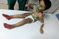 الطفل الضحية