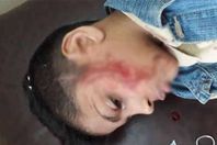 الطفل الضحية