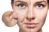 تجاعيد الوجه