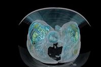 رئة مصابة بكورونا