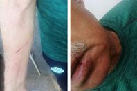 الاعتداء على بعثة الرجاء