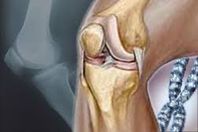 المؤتمر السنوى الأول لجراحة العظام ينعقد في طب عين شمس