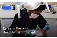 إسراء أول طبيبة أسنان مصرية صماء