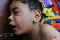 الطفل ضحية تعذيب الأم