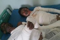 الحوثيون يقتلون 30 يمنيًا حرقًا بالحديدة