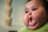 طفل بدين (أرشيفية)