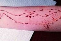 الحوت الأزرق