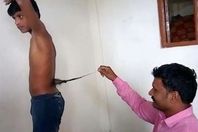 نمو ذيل بظهر شاب هندي 
