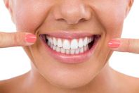 تبييض الأسنان

