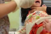 ختان الاناث