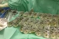 امرأة تبتلع 7000 الف دولار في كولومبيا