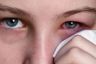 6خطوات لتجنب أمراض العيون صيفًا