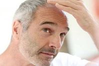 الصدفة تكشف عن سبب الإصابة بالصلع والشعر الرمادي