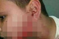 الطفل المصاب